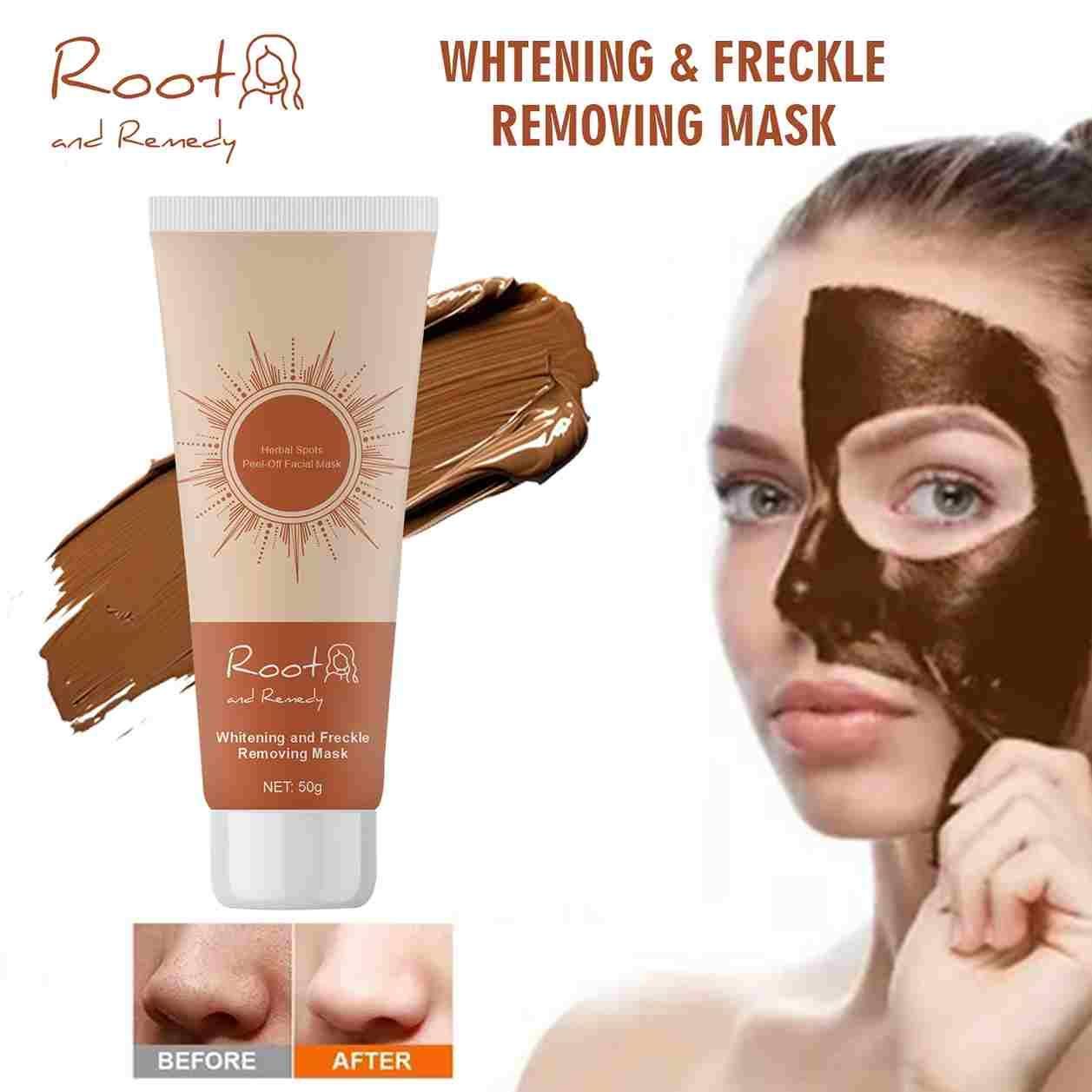 Radiant Glow Whitening & Freckle Removal Cream – 50g (Pack of 2)